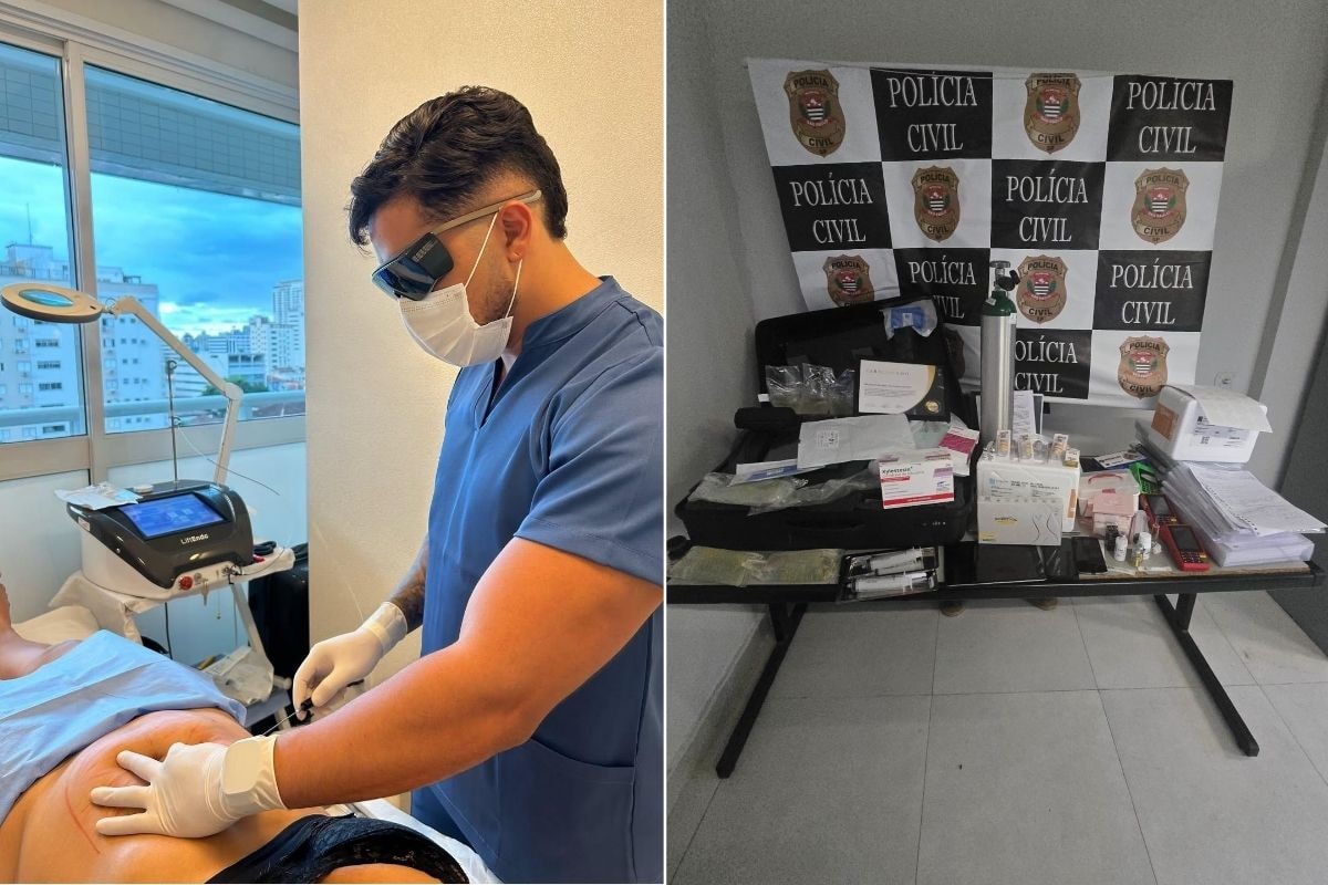 Influencer fingia ser médico para fazer cirurgia estética em pacientes