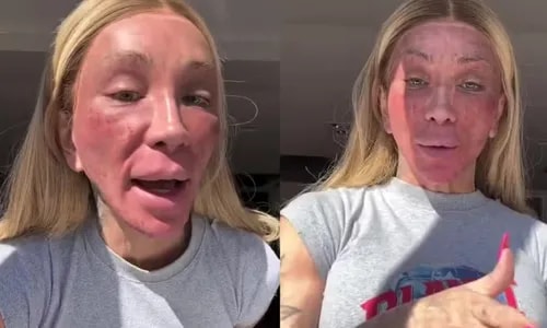 Maya Massafera surge com rosto irreconhecível e faz desabafo na web